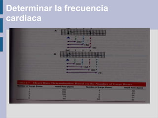 Determinar la frecuencia
cardiaca
 