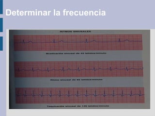 Determinar la frecuencia
 