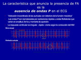La característica que anuncia la presencia de FA
es la
ausencia de ondas P en el ECG
Fibrilaciónauricular
P T
Q
S
R
ACC/AHA/ESC2006guidelines JAmColl Cardiol 2006;48:854
• “Activación incoordinadadelasaurículas condeteriorodela función mecánica“
• LasondasPsonreemplazadaspor oscilacionesrápidasuondasfibrilatoriasque
varíanenamplitud,formaymomentodeaparición.
• Larespuestaventricularesirregular , rápida olentasegúnla conduccióndelNA
V
Ritmosinusal
ondaP
IntervaloR-R
 