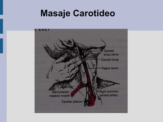 Masaje Carotideo
 