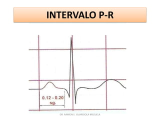 DR. RAMÓN E. GUARDIOLA BRIZUELA
INTERVALO P-R
 