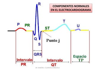 DR. RAMÓN E. GUARDIOLA BRIZUELA
Espacio
COMPONENTES NORMALES
EN EL ELECTROCARDIOGRAMA
 
