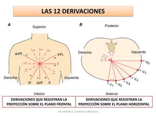 DR. RAMÓN E. GUARDIOLA BRIZUELA
LAS 12 DERIVACIONES
DERIVACIONES QUE REGISTRAN LA
PROYECCIÓN SOBRE EL PLANO FRONTAL
DERIVACIONES QUE REGISTRAN LA
PROYECCIÓN SOBRE EL PLANO HORIZONTAL
 