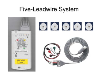 Five-Leadwire System 