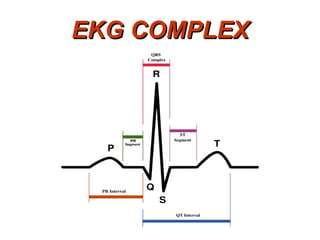 EKG COMPLEX 