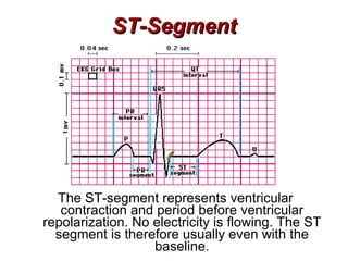 ST-Segment The ST-segment represents ventricular contraction and period before ventricular repolarization. No electricity is flowing. The ST segment is therefore usually even with the baseline. 