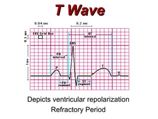 T Wave Depicts ventricular repolarization Refractory Period 