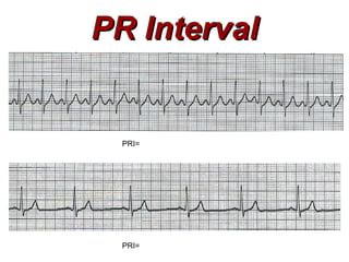 Cardiac Electrophysiology | PPT