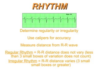 Cardiac Electrophysiology | PPT