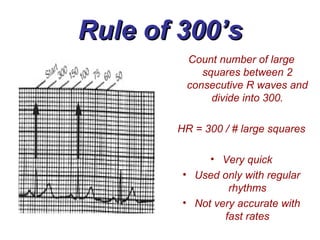 Rule of 300’s Count number of large squares between 2 consecutive R waves and divide into 300. HR = 300 / # large squares Very quick Used only with regular rhythms Not very accurate with fast rates 