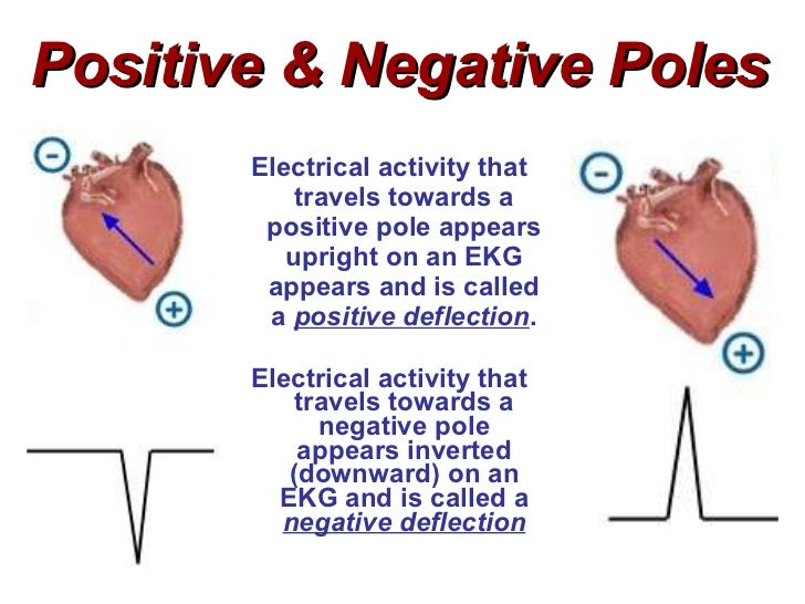 Cardiac Electrophysiology