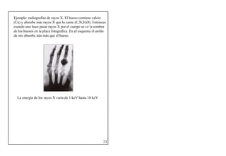 12
Ejemplo: radiografías de rayos X. El hueso contiene calcio
(Ca) y absorbe más rayos X que la carne (C,N,H,O). Entonces
cuando uno hace pasar rayos X por el cuerpo se ve la sombra
de los huesos en la placa fotográfica. En el esquema el anillo
de oro absorbe aún más que el hueso.
La energía de los rayos X varía de 1 keV hasta 10 keV
23
 