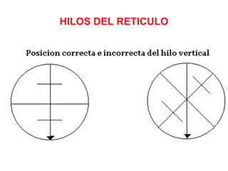 HILOS DEL RETICULO
 