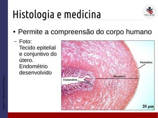 Histologia e medicina
Imagem:http://www2.unifesp.br/
● Permite a compreensão do corpo humano
– Foto:
Tecido epitelial
e conjuntivo do
útero.
Endométrio
desenvolvido
 