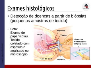 Exames histológicos
Imagem:http://www2.unifesp.br/
● Detecção de doenças a partir de biópsias
(pequenas amostras de tecido)
– Foto:
Exame de
papanicolau.
Tecido
coletado com
espátula e
analisado no
microscópio
 