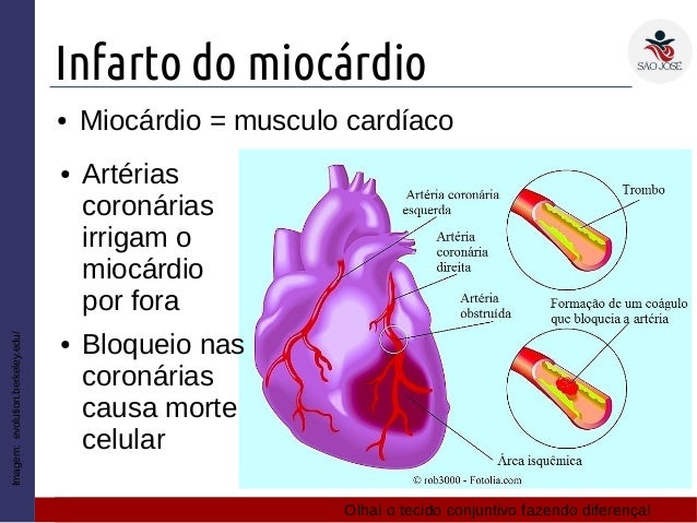1EM #34 Tecido muscular