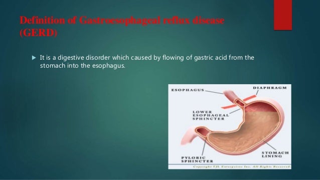 Gastroesophageal Reflux Disease and Exercise (GERD)