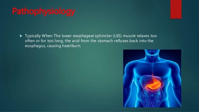 Gastroesophageal Reflux Disease and Exercise (GERD)