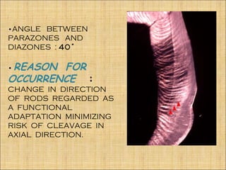 •ANGLE BETWEEN
PARAZONES AND
DIAZONES : 40˚

•REASON FOR
OCCURRENCE :
CHANGE IN DIRECTION
OF RODS REGARDED AS
A FUNCTIONAL
ADAPTATION MINIMIZING
RISK OF CLEAVAGE IN
AXIAL DIRECTION.
 