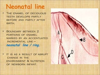 Neonatal line
• The enamel of deciduous
  teeth develops partly
  before and partly after
  birth.

• Boundary between 2
  portions of enamel
  marked by an accentuated
  incremental line –
  neonatal line / ring.

• It is as a result of abrupt
   change in the
  environment & nutrition
  of newborn infant.
 