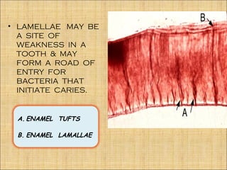 • LAMELLAE MAY BE
  A SITE OF
  WEAKNESS IN A
  TOOTH & MAY
  FORM A ROAD OF
  ENTRY FOR
  BACTERIA THAT
  INITIATE CARIES.


 A. ENAMEL TUFTS

 B. ENAMEL LAMALLAE
 