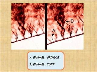 A. ENAMEL SPINDLE

B. ENAMEL TUFT
 