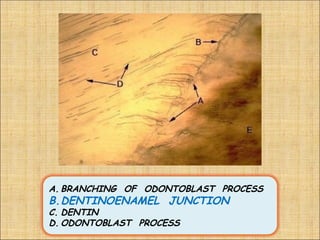 A. BRANCHING OF ODONTOBLAST PROCESS
B.DENTINOENAMEL JUNCTION
C. DENTIN
D. ODONTOBLAST PROCESS
 