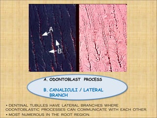 A. ODONTOBLAST PROCESS

               B. CANALICULI / LATERAL
                  BRANCH

• DENTINAL TUBULES HAVE LATERAL BRANCHES WHERE
ODONTOBLASTIC PROCESSES CAN COMMUNICATE WITH EACH OTHER.
• MOST NUMEROUS IN THE ROOT REGION.
 