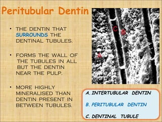 Peritubular Dentin
 • THE DENTIN THAT
   SURROUNDS THE
   DENTINAL TUBULES.

 • FORMS THE WALL OF
   THE TUBULES IN ALL
   BUT THE DENTIN
   NEAR THE PULP.

 • MORE HIGHLY
   MINERALISED THAN     A. INTERTUBULAR DENTIN
   DENTIN PRESENT IN
   BETWEEN TUBULES.     B. PERITUBULAR DENTIN

                        C. DENTINAL TUBULE
 