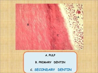 A. PULP

  B. PRIMARY DENTIN

C. SECONDARY     DENTIN
 
