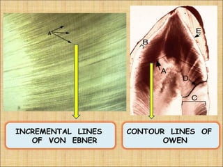 INCREMENTAL LINES   CONTOUR LINES OF
   OF VON EBNER            OWEN
 