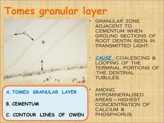 Tomes granular layer
                           •   GRANULAR ZONE
                               ADJACENT TO
                               CEMENTUM WHEN
                               GROUND SECTIONS OF
                               ROOT DENTIN SEEN IN
                               TRANSMITTED LIGHT.

                           •   CAUSE : COALESCING &
                               LOOPING OF THE
                               TERMINAL PORTIONS OF
                               THE DENTINAL
                               TUBULES.

                           •   AMONG
A. TOMES GRANULAR LAYER
                               HYPOMINERALISED
                               AREAS – HIGHEST
B. CEMENTUM                    CONCENTRATION OF
                               CALCIUM &
C. CONTOUR LINES OF OWEN       PHOSPHORUS.
 