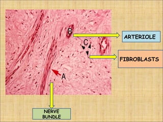ARTERIOLE



         FIBROBLASTS




 NERVE
BUNDLE
 