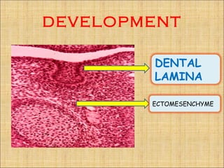 DEVELOPMENT

        DENTAL
        LAMINA

        ECTOMESENCHYME
 