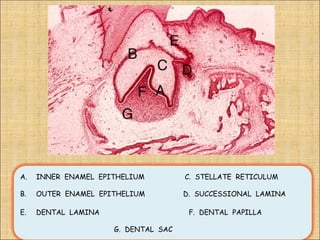 A.   INNER ENAMEL EPITHELIUM         C. STELLATE RETICULUM

B.   OUTER ENAMEL EPITHELIUM         D. SUCCESSIONAL LAMINA

E.   DENTAL LAMINA                    F. DENTAL PAPILLA

                     G. DENTAL SAC
 