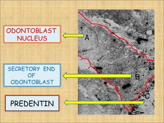 ODONTOBLAST
  NUCLEUS



SECRETORY END
      OF
 ODONTOBLAST



PREDENTIN
 