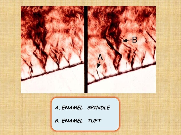 1 enamel dentin pulp