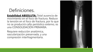 Definiciones.
Estabilidad ABSOLUTA: Total ausencia de
movimiento en el foco de fractura. Reduce
la tensión en el foco de fractura, por lo que
no se producirá callo perióstico externo, es
una CONSOLIDACIÓN PRIMARIA.
Requiere reducción anatómica,
vascularización preservada, y una
compresión interfragmentaria.
 