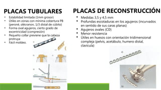 PLACAS TUBULARES
• Estabilidad limitada (1mm grosor)
• Útiles en zonas con mínima cobertura PB
(peroné, olécranon, 1/3 distal de cúbito)
• Forma oval agujeros, cierto grado de
excentricidad (compresión)
• Pequeño collar previene que la cabeza
protruya
• Fácil moldeo.
PLACAS DE RECONSTRUCCIÓN
 Medidas 3,5 y 4,5 mm
 Profundas escotaduras en los agujeros (incurvados
en sentido de sus caras planas)
 Agujeros ovales (CD)
 Menor resistencia
 Útiles en huesos con orientación tridimensional
compleja (pelvis, acetábulo, humero distal,
clavícula)
 