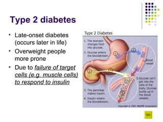 Type 2 diabetes Late-onset diabetes (occurs later in life) Overweight people more prone Due to  failure of target cells (e.g. muscle cells) to respond to insulin   