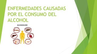 ENFERMEDADES CAUSADAS
POR EL CONSUMO DEL
ALCOHOL
 