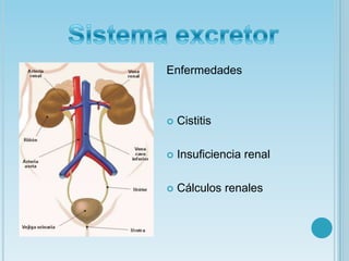 EnfermedadesCistitisInsuficiencia renal Cálculos renalesSistema excretor 