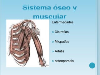 Sistema óseo y muscularEnfermedadesDistrofiasMiopatíasArtritisosteoporosis