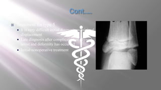  Treatment for type 5
 It is very difficult initial diagnosis as minimal
displacement
 Late diagnosis after complication of physeal
arrest and deformity has occurred
 Initial nonoperative treatment
 