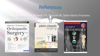 Levine RH, Foris LA, Nezwek TA, Waseem M. Salter-Harris Fractures.
StatPearls. StatPearls Publishing; 2021.
 
