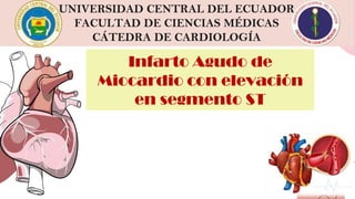 Infarto Agudo de
Miocardio con elevación
en segmento ST
UNIVERSIDAD CENTRAL DEL ECUADOR
FACULTAD DE CIENCIAS MÉDICAS
CÁTEDRA DE CARDIOLOGÍA
 
