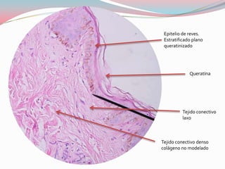 Epitelio de reves.
 Estratificado plano
 queratinizado




             Queratina




          Tejido conectivo
          laxo



Tejido conectivo denso
colágeno no modelado
 