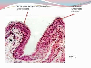 Ep. de reves. estratificado polimorfo     Ep. de reves.
(de transición)                           Estratificado
                                          cilíndrico.




                                        (Uretra)
 