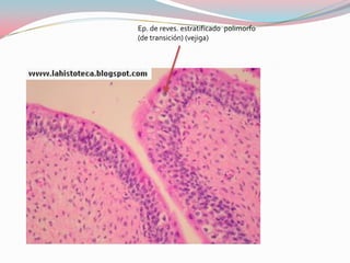 Ep. de reves. estratificado polimorfo
(de transición) (vejiga)
 