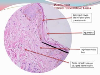 Piel (Dermis)
Tinción: Hematoxilina y Eosina

               Epitelio de reves.
               Estratificado plano
               queratinizado




                           Queratina




                        Tejido conectivo
                        laxo



              Tejido conectivo denso
              colágeno no modelado
 
